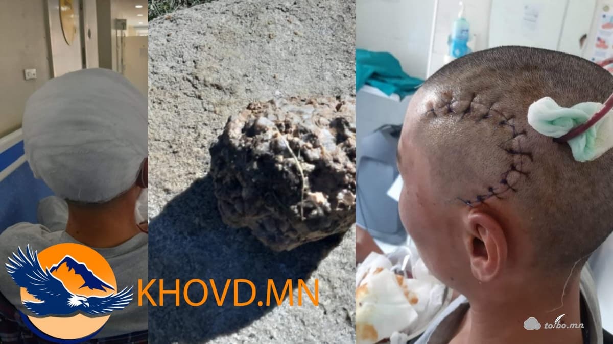 Хохирогч Д-ийн аав: Хүүгийн минь амь үлдэж, эрүүл мэнд хохирлоо хэмээн хоолой нь зангирав