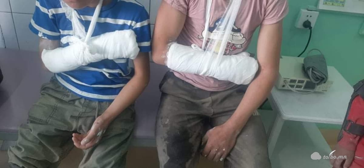 Бүсийн уралдаанаас 1 хүүхэд тархиндаа хүнд гэмтэл авч, 4 хүүхдийн гар хугарч,1 хүүхэд шагайндаа гэмтэл авсан байна